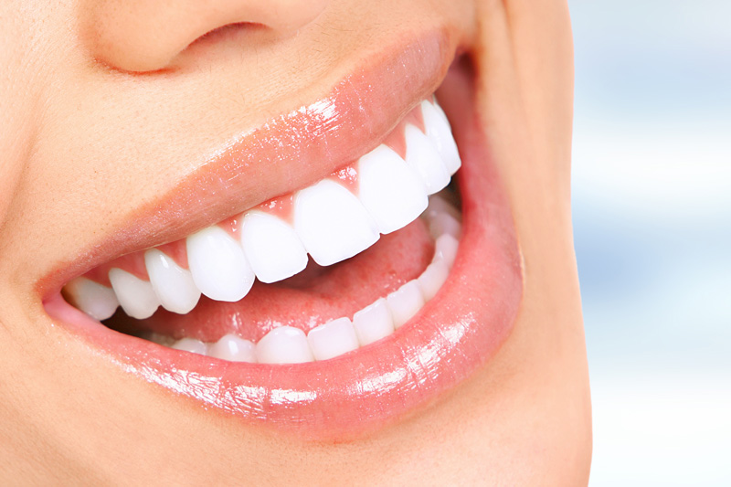 Cosmetic Dentistry in Van Wert